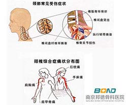 颈椎病可以吗