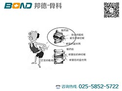 腰椎病治疗方法