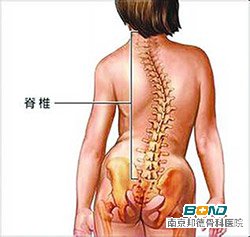 引起后天脊柱侧弯的原因