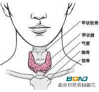 食道型颈椎病症状