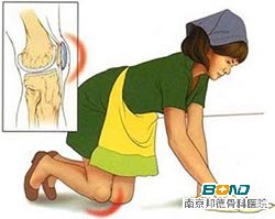 滑囊炎的症状有哪些