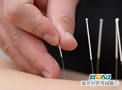 腰肌劳损腿疼什么原因