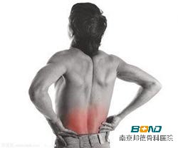 慢性腰肌劳损症状