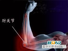 肘关节骨刺的治疗方法？