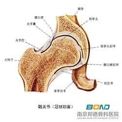 髋关节滑膜炎的诊断方法