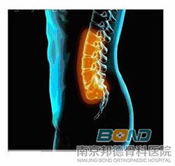 腰椎骨质增生怎么鉴别诊断